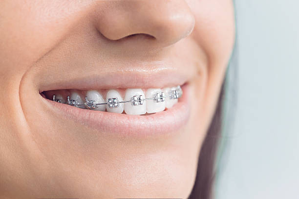 Best Wisdom Tooth Removal  in Kendall, FL